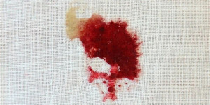 the stunning eucharistic miracle of sokolka