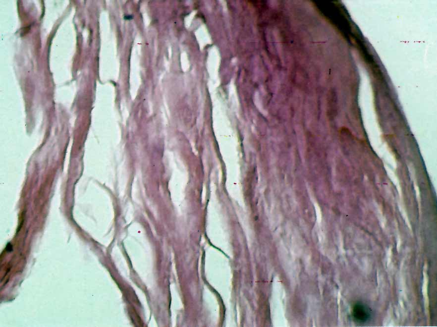 Fig. 1 Eosina x 200